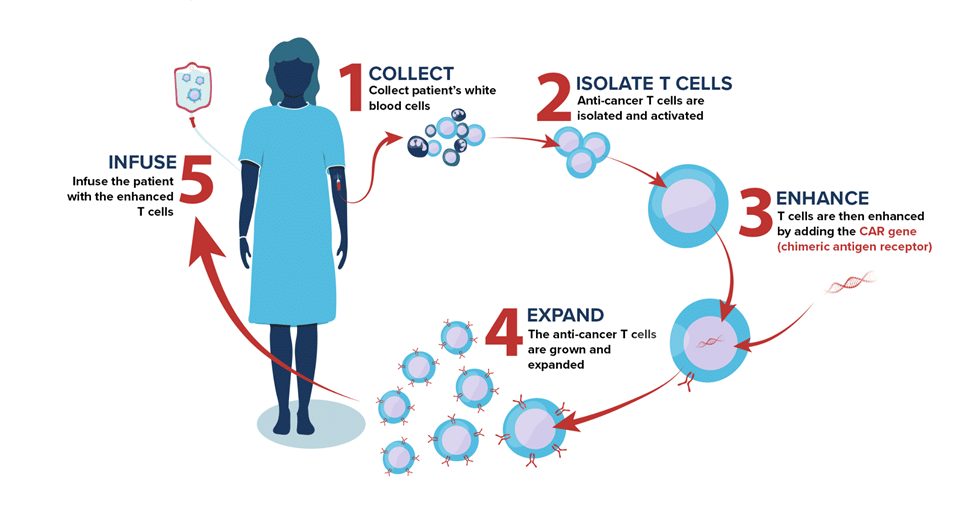 Diagram illustrating the five steps of CAR T cell immunotherapy: collecting blood, isolating T cells, enhancing them with CAR genes, expanding modified cells, and infusing them back into the patient.