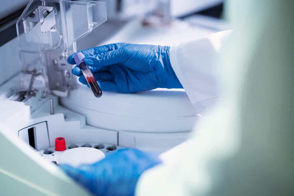 Close-up of a researcher handling a blood sample in a laboratory, representing BioCanRx’s focus on translational research and clinical innovation in Canada.